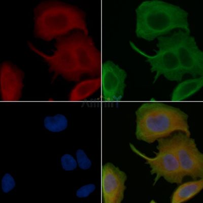 CCDC82 Antibody - DF15957 staining Hela cells(45min of heat-shock treatment) by IF/ICC.