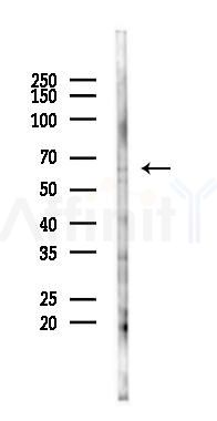 UNC5C Antibody - Western blot analysis of lysates from COLO205 cells(starvation 24h treatment), using UNC5C Antibody at 1/1000 dilution.