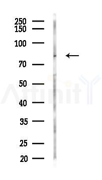 NFE2L1 Antibody - Western blot analysis of lysates from K562 cells(LPS 4h treatment), using NFE2L1 Antibody at 1/1000 dilution.