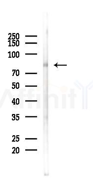EPB41 Antibody - Western blot analysis of lysates from K562 cells(heat-shock 45min treatment), using EPB41 Antibody at 1/1000 dilution.