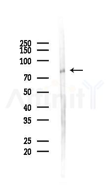 EPB41 Antibody - Western blot analysis of lysates from COLO205 cells(starvation 24h treatment), using EPB41 Antibody at 1/1000 dilution.