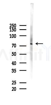 ELL2 Antibody - Western blot analysis of lysates from COLO205 cells(starvation 24h treatment), using ELL2 Antibody at 1/1000 dilution.