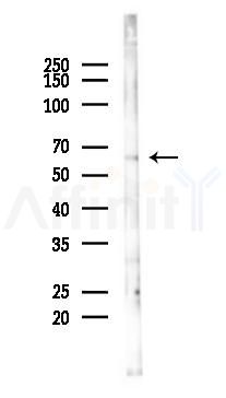 SH3BP2 Antibody - Western blot analysis of lysates from K562 cells(heat-shock 45min treatment), using SH3BP2 Antibody at 1/1000 dilution.
