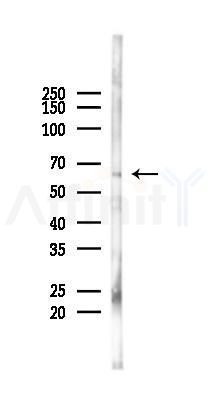 SH3BP2 Antibody - Western blot analysis of lysates from COLO205 cells(starvation 24h treatment), using SH3BP2 Antibody at 1/1000 dilution.