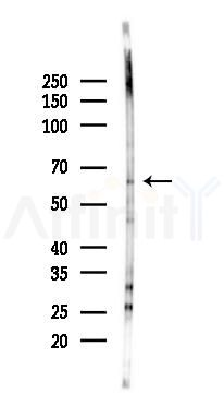 SH3BP2 Antibody - Western blot analysis of lysates from Rat testis, using SH3BP2 Antibody at 1/1000 dilution.