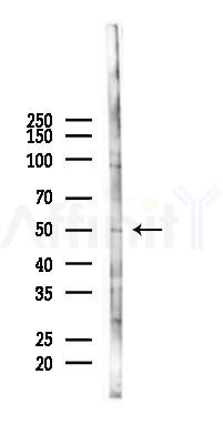 VPS4B Antibody - Western blot analysis of lysates from COLO205 cells(starvation 24h treatment), using VPS4B Antibody at 1/1000 dilution.
