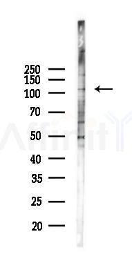 ADCY2 Antibody - Western blot analysis of lysates from A2780 cells(LPS 4h treatment), using ADCY2 Antibody at 1/1000 dilution.