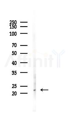 BCL2L10 Antibody - Western blot analysis of lysates from K562 cells(heat-shock 45min treatment), using BCL2L10 Antibody at 1/1000 dilution.