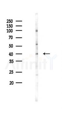 CCNY Antibody - Western blot analysis of lysates from Hela cells(UV 30min treatment), using CCNY Antibody at 1/1000 dilution.