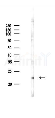 CD40L Antibody - Western blot analysis of lysates from RAW264.