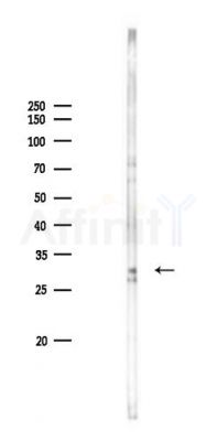 CD81 Antibody - Western blot analysis of lysates from Rat brain, using CD81 Antibody at 1/1000 dilution.