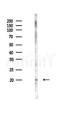 CENPS Antibody - Western blot analysis of lysates from Hela cells(UV 30min treatment), using CENPS Antibody at 1/1000 dilution.
