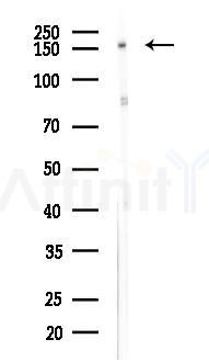 LAMC3 Antibody - Western blot analysis of lysates from K562 cells(LPS 4h treatment), using LAMC3 Antibody at 1/1000 dilution.