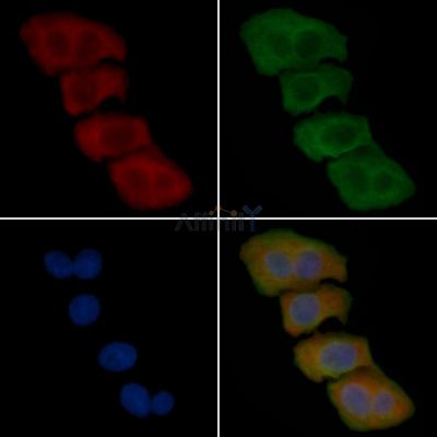 PEA15 Antibody - DF2387 staining Hela cells(30min of UV treatment) by IF/ICC.