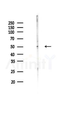 TAF7L Antibody - Western blot analysis of lysates from Hela cells(UV 30min treatment), using TAF7L Antibody at 1/1000 dilution.