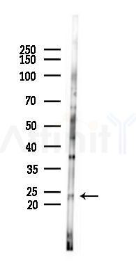 DUSP26 Antibody - Western blot analysis of lysates from B16F10-LUC cells(LPS 4h treatment), using DUSP26 Antibody at 1/1000 dilution.