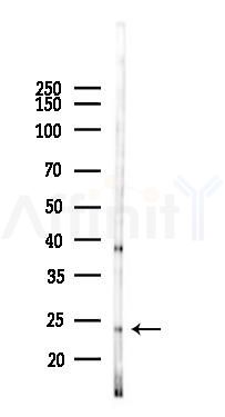 DUSP26 Antibody - Western blot analysis of lysates from 293 cells(heat-shock 45min treatment), using DUSP26 Antibody at 1/1000 dilution.