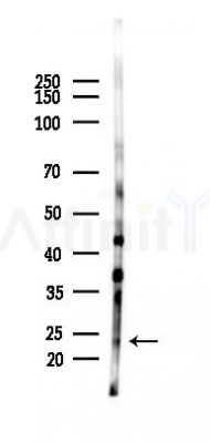 DUSP26 Antibody - Western blot analysis of lysates from Rat brain, using DUSP26 Antibody at 1/1000 dilution.