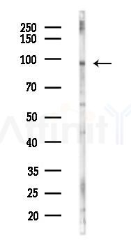 BCL11B Antibody - Western blot analysis of lysates from K562 cells(LPS 4h treatment), using BCL11B Antibody at 1/1000 dilution.
