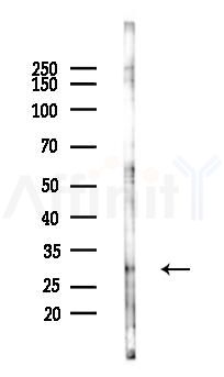 MED20 Antibody - Western blot analysis of lysates from PC12 cells(heat-shock 45min treatment), using MED20 Antibody at 1/1000 dilution.