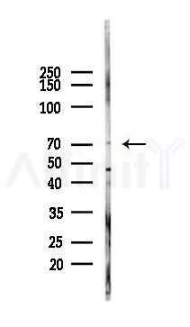 ABCG2 Antibody - Western blot analysis of lysates from Hela cells(LPS, 4h treatment), using ABCG2 Antibody at 1/1000 dilution.