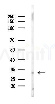 RRP7 Antibody - Western blot analysis of lysates from Mouse lung, using RRP7 Antibody at 1/1000 dilution.
