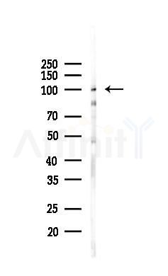 IL12RB1 Antibody - Western blot analysis of lysates from Rat brain, using IL12RB1 Antibody at 1/1000 dilution.