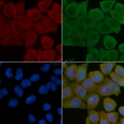 IL17RD Antibody - DF2511 staining Hela cells(45min of heat-shock treatment) by IF/ICC.