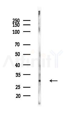 IGFBPL1 Antibody - Western blot analysis of lysates from Mouse kidney, using IGFBPL1 Antibody at 1/1000 dilution.
