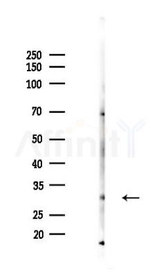 IN35 Antibody - Western blot analysis of lysates from PC12 cells(heat-shock 45min treatment), using IN35 Antibody at 1/1000 dilution.