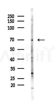 IFNAR2 Antibody - Western blot analysis of lysates from Mouse lung, using IFNAR2 Antibody at 1/1000 dilution.