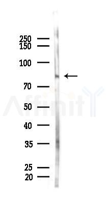 ITGB6 Antibody - Western blot analysis of lysates from Mouse lung, using ITGB6 Antibody at 1/1000 dilution.