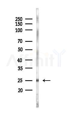 ITBP1 Antibody - Western blot analysis of lysates from Rat brain, using ITBP1 Antibody at 1/1000 dilution.