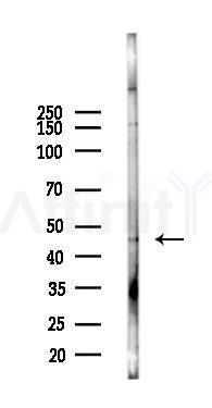K2C6B/C Antibody - Western blot analysis of lysates from Hela cells(UV 30min treatment), using K2C6B/C Antibody at 1/1000 dilution.
