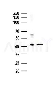 MAPRE2 Antibody - Western blot analysis of lysates from Rat brain, using MAPRE2 Antibody at 1/1000 dilution.