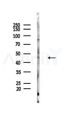 BCL7B Antibody - Western blot analysis of lysates from K562 cells(heat-shock 45min treatment), using BCL7B Antibody at 1/1000 dilution.