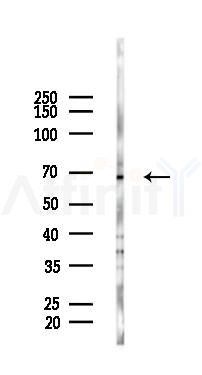 KLF12 Antibody - Western blot analysis of lysates from K562 cells(heat-shock 45min treatment), using KLF12 Antibody at 1/1000 dilution.