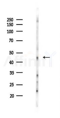 SP5/8/9 Antibody - Western blot analysis of lysates from Mouse lung, using SP5/8/9 Antibody at 1/1000 dilution.