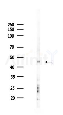 SP5/8/9 Antibody - Western blot analysis of lysates from COLO205 cells(heat-shock 45min treatment), using SP5/8/9 Antibody at 1/1000 dilution.