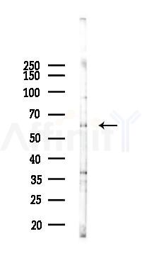 Cytochrome P450 7A1 Antibody - Western blot analysis of lysates from B16F10-LUC cells(LPS 4h treatment), using Cytochrome P450 7A1 Antibody at 1/1000 dilution.