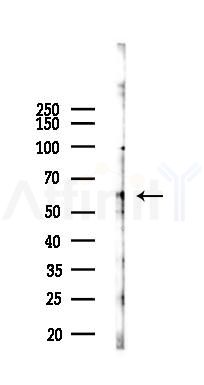 Cytochrome P450 7A1 Antibody - Western blot analysis of lysates from HUVEC cells(LPS 4h treatment), using Cytochrome P450 7A1 Antibody at 1/1000 dilution.