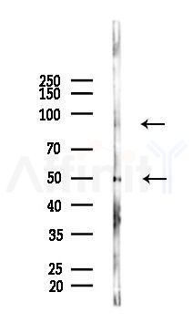 BCL2L13 Antibody - Western blot analysis of lysates from K562 cells(heat-shock 45min treatment), using BCL2L13 Antibody at 1/1000 dilution.