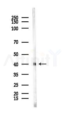 ACTA1/A2/C1 Antibody - Western blot analysis of lysates from Mouse lung, using ACTA1/A2/C1 Antibody at 1/1000 dilution.