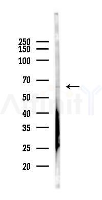 AMPK alpha 2 Antibody - Western blot analysis of lysates from HUVEC cells(heat-shock 45min treatment), using AMPK alpha 2 Antibody at 1/1000 dilution.