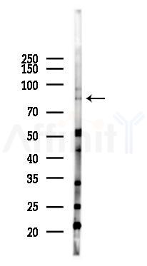 SNRK Antibody - Western blot analysis of lysates from HUVEC cells(heat-shock 45min treatment), using SNRK Antibody at 1/1000 dilution.