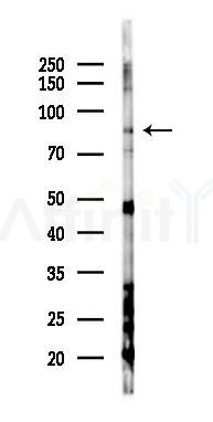 SNRK Antibody - Western blot analysis of lysates from Hela cells(heat-shock 45min treatment), using SNRK Antibody at 1/1000 dilution.