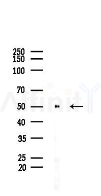 VRK2 Antibody - Western blot analysis of lysates from K562 cells(heat-shock 45min treatment), using VRK2 Antibody at 1/1000 dilution.