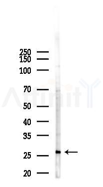 KLK12 Antibody - Western blot analysis of lysates from HUVEC cells(heat-shock 45min treatment), using KLK12 Antibody at 1/1000 dilution.