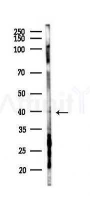 GPR22 Antibody - Western blot analysis of lysates from PC12 cells(starvation 24h treatment), using GPR22 Antibody at 1/1000 dilution.