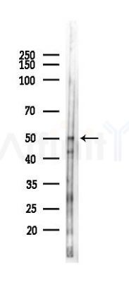 GPR83/GPR72 Antibody - Western blot analysis of lysates from Hela cells(heat-shock 45min treatment), using GPR83/GPR72 Antibody at 1/1000 dilution.